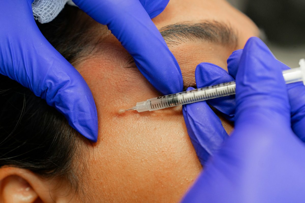 Botox Near Me What To Expect Benefits And How To Choose The Right botox-near-me-what-to-expect-benefits-and-how-to-choose-the-right