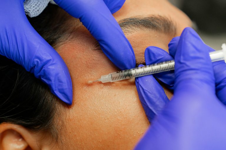 Botox treatment